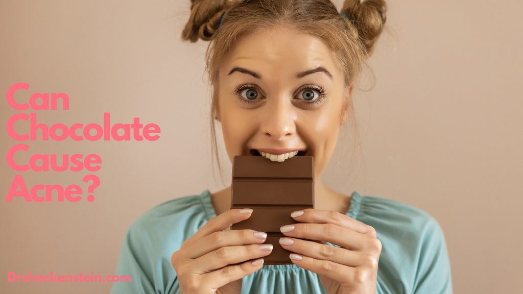 Can Chocolate Cause Acne?